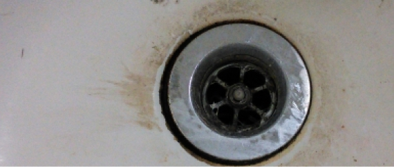 汚れた排水口